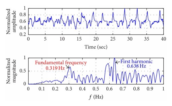 CW Radar The-time-domain-and-the-discrete-time-Fourier-transform-of-the-breathing-signal-reflected